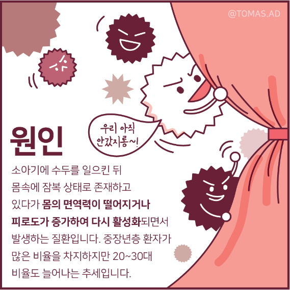 대상포진 원인