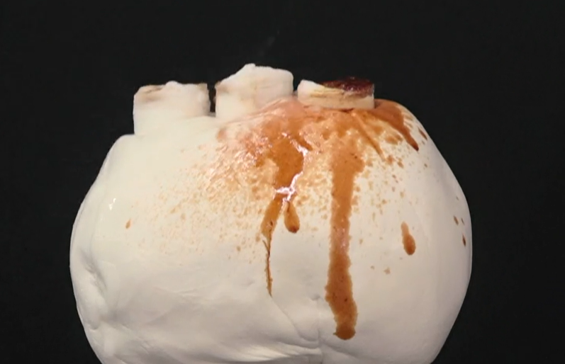 콘드로이친 효능