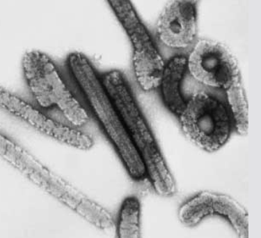 [법정 감염병] 마버그열 증상 및 감염 경로, 예방 방법