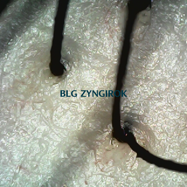 탈모 극복 프로젝트 - 뒷머리 두피 모습이다.