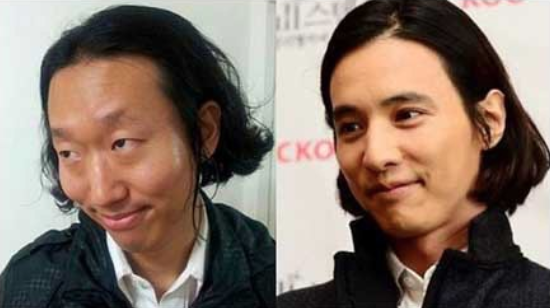 탈모 관련 3대장 주