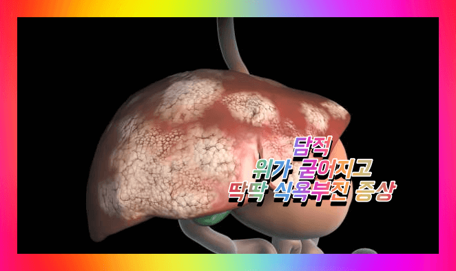 담적질환 증상이유 자가진단