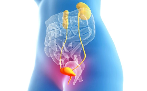 신우신염 증상 4가지