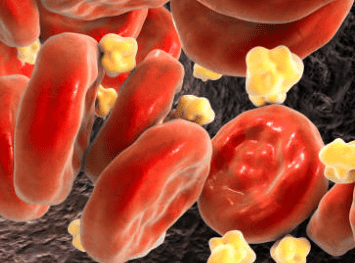 중성지방 낮추는 방법&amp;#44; 중성지방 정상수치