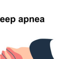 마운자로 효과입증