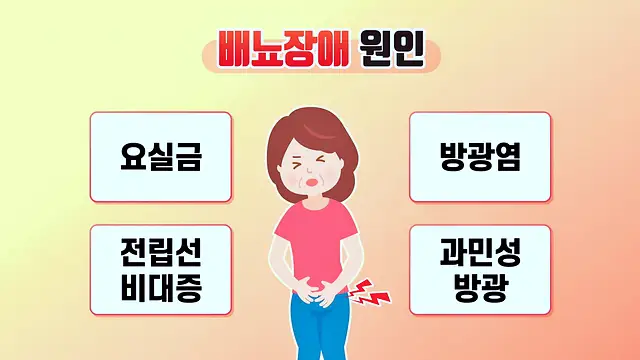 SBS 좋은아침 요실금 방광염 전립선 비대증 과민성 방광 배뇨장애 예방 관리 방법 추천 오늘방송 정보 다시보기