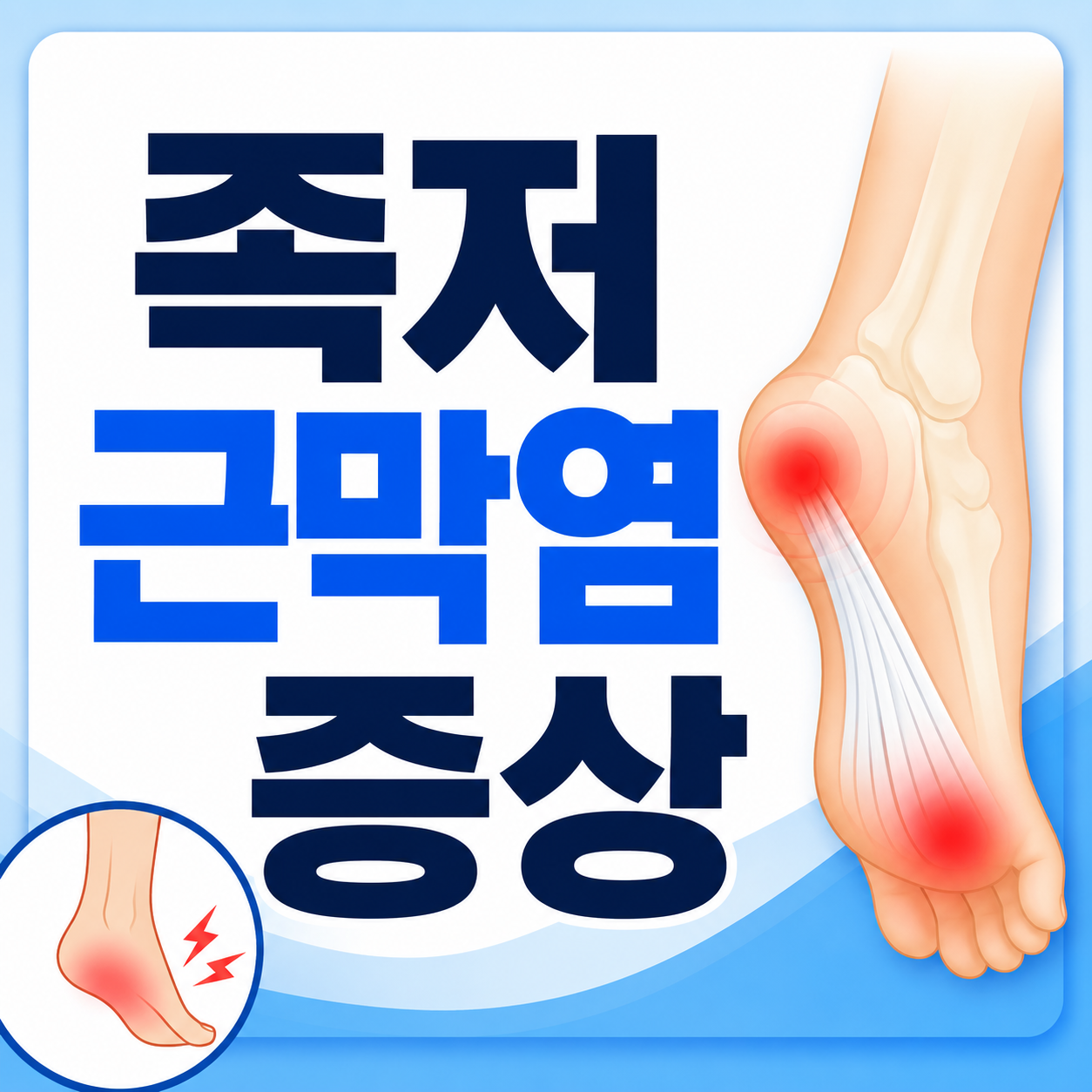 족저 근막염 증상