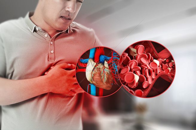 triglycerides 정상 수치