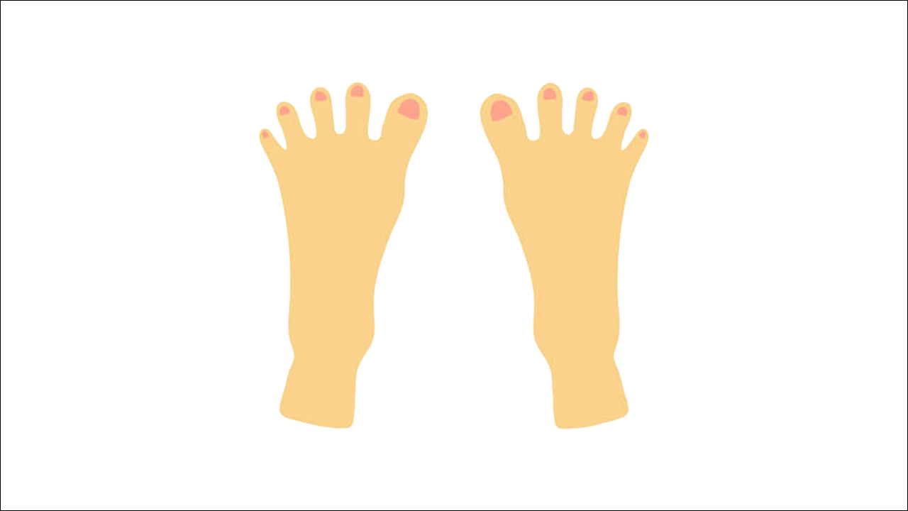 무지외반증과 하지정맥류 예방 발 건강 지키는 법