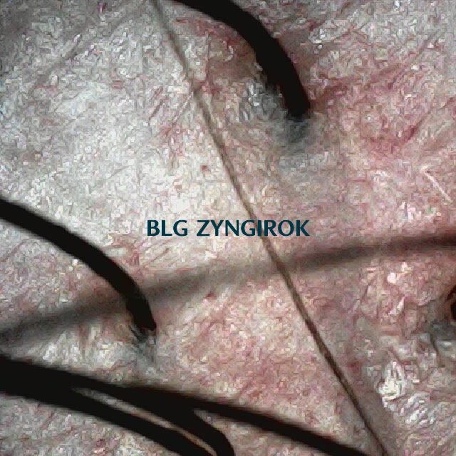 피나모아 복용 16주차 - 뒷머리 두피모습이다.