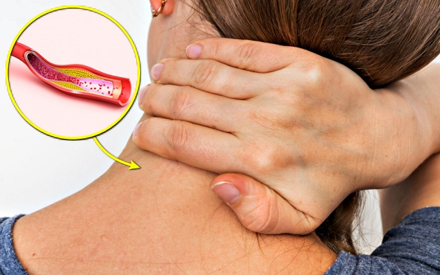 뒷골이 땡기면서 머리가 아파요 뒷목이 뻐근한 증상 뇌동맥류 파열 지주막하출혈, 건강 팁줌 매일꿀정보