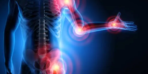 커큐민 추천-목적정리