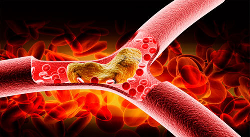 고지혈증에 좋은 음식 10가지!