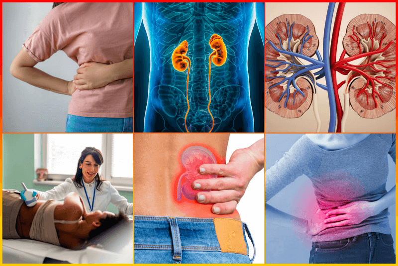 신장 위치 및 통증 위치