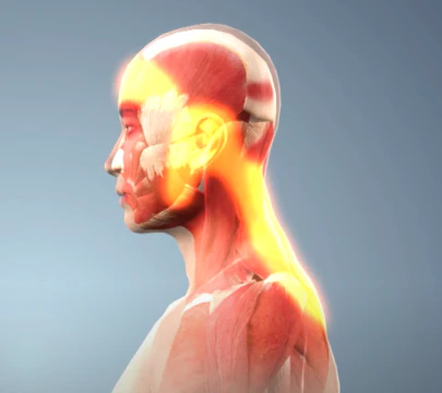 열은 없고 두통만 심한 경우, 원인과 해결