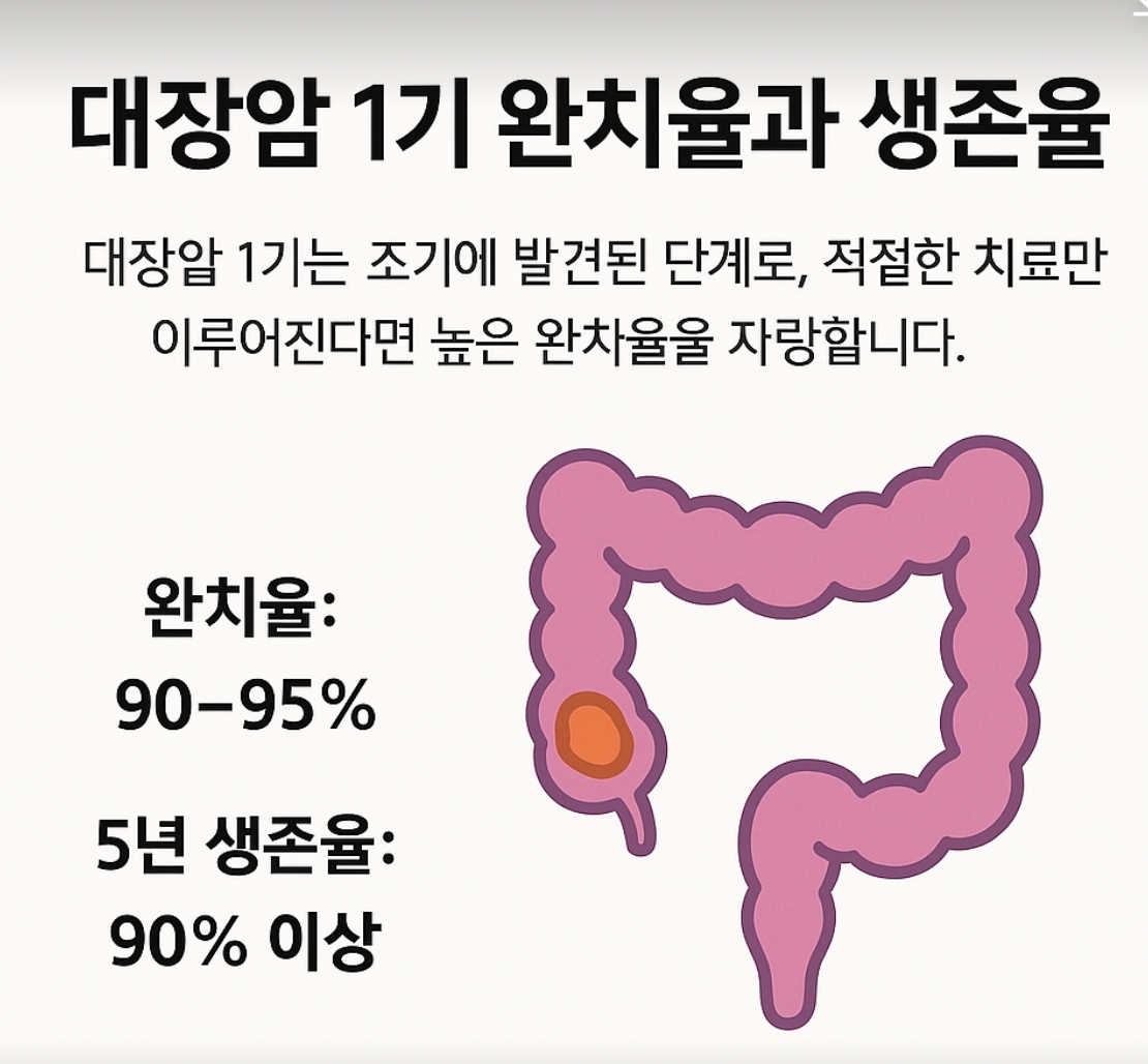 대장암1기 완치율과 생존율