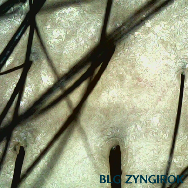 피나모아 복용 7주차 두피사진 - 정수리 위치 모습이다.