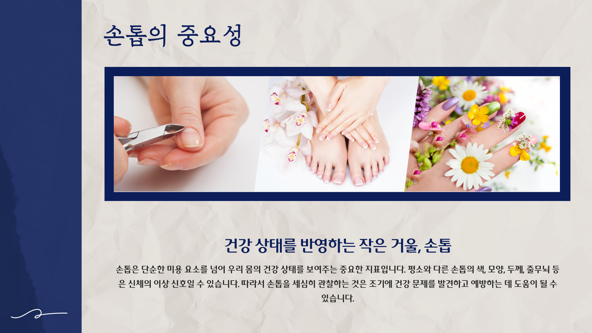 손톱으로 보는 건강상태