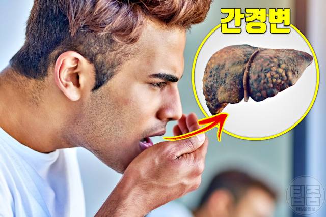 입냄새로 알아보는 건강 입냄새 곰팡이 간경변