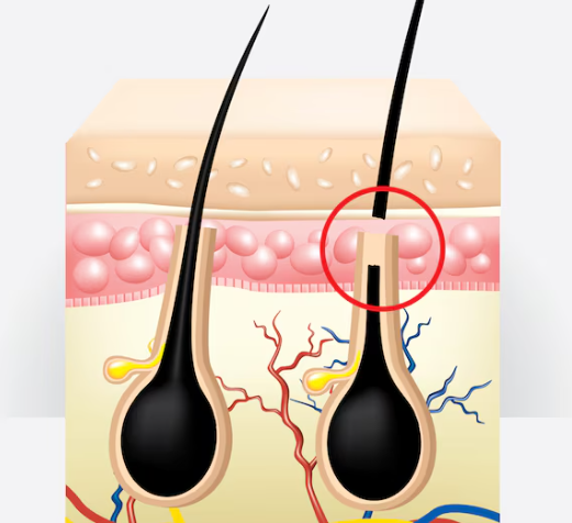 홈케어 활용 셀프 관리