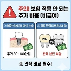 임플란트 비급여 항목