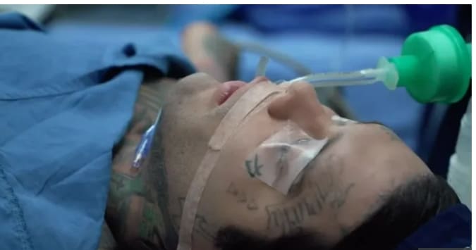 세계에서 가장 고통스러운 수술 받은 남성...왜 VIDEO: The world&rsquo;s most painful op to get a bit taller&hellip; i