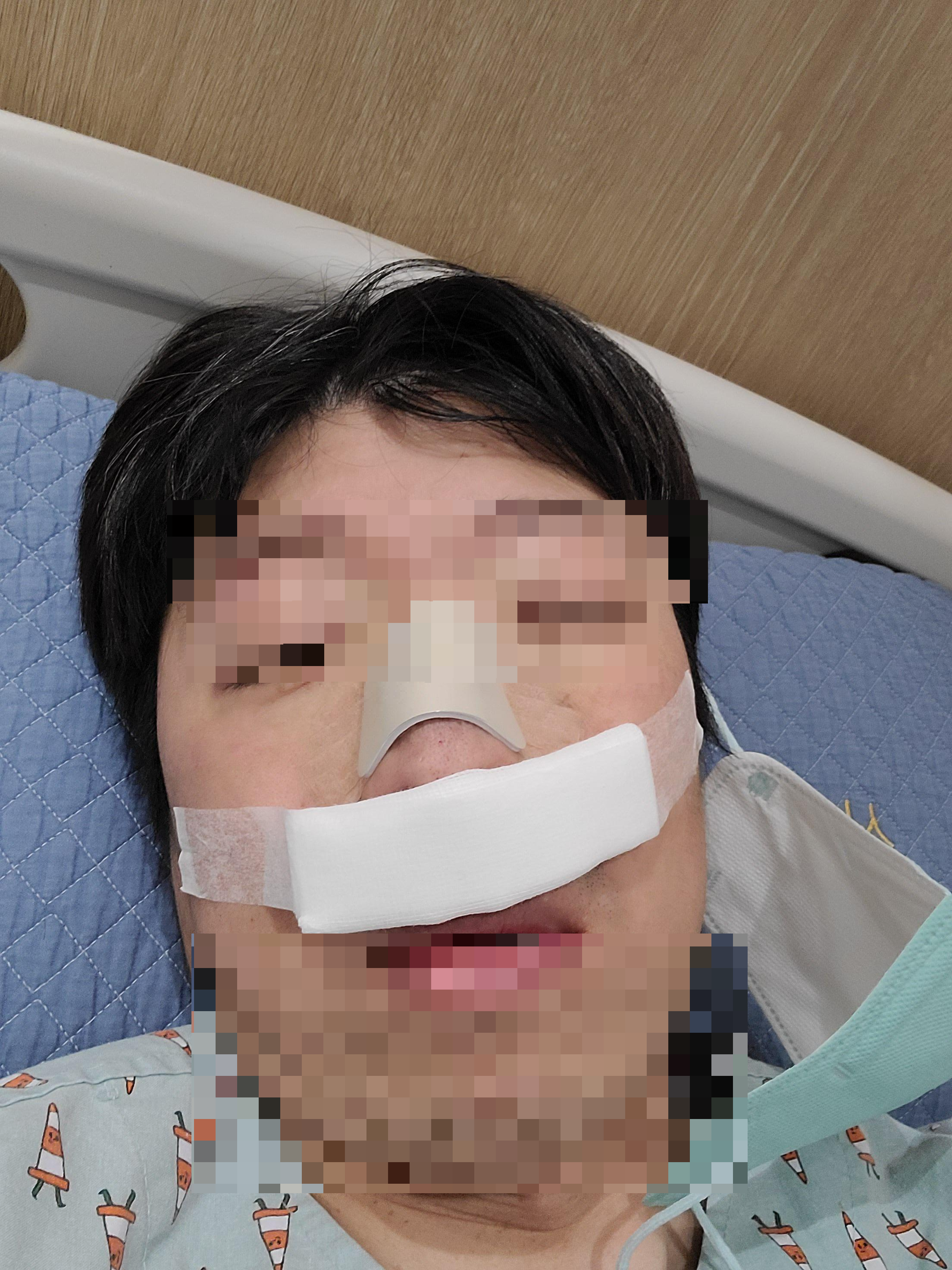 수술 후 병원에서