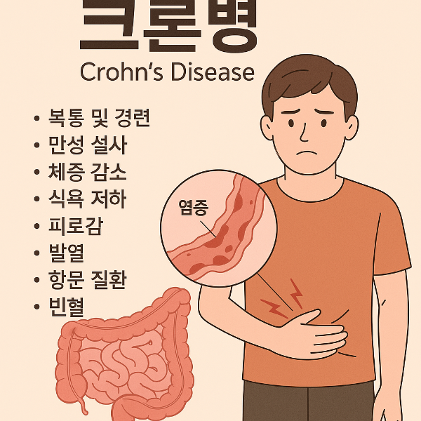 크론병 증상 이미지