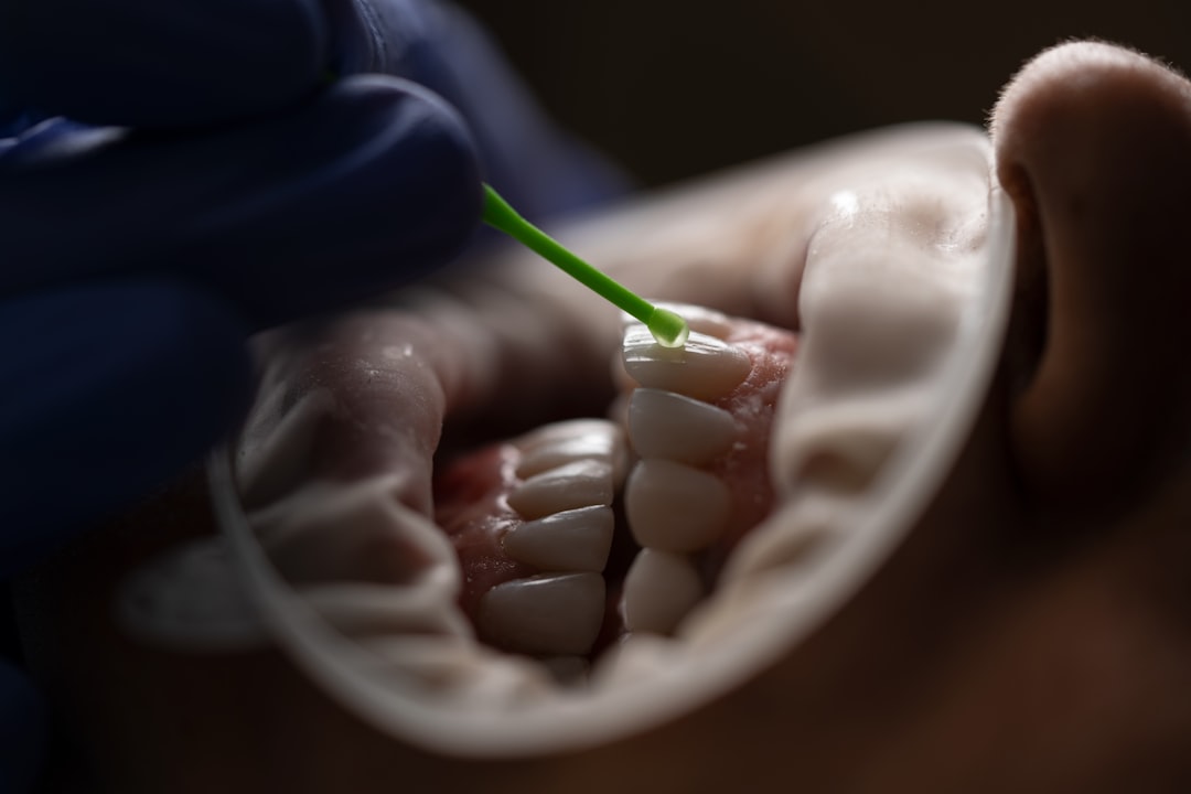 Jaw joint.