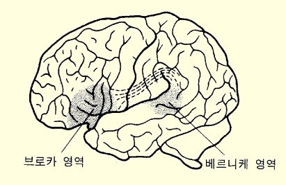 좌반구 기능으로서의 언어
