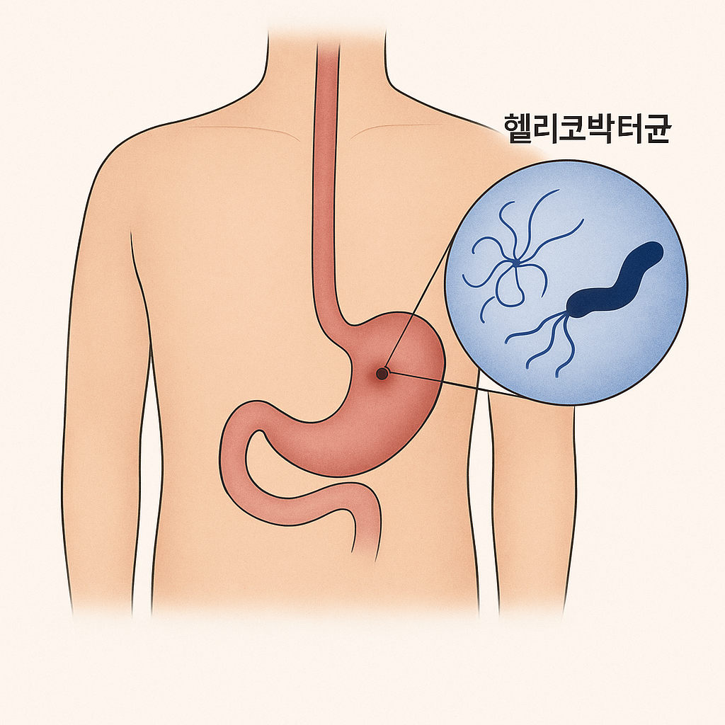 헬리코박터균에 관련된 사진