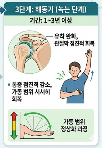 오십견 원인