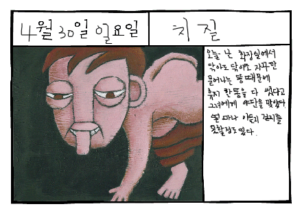 치질(痔疾, hemorrhoid)