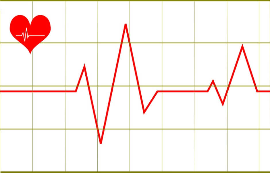 심장 혈류 속도