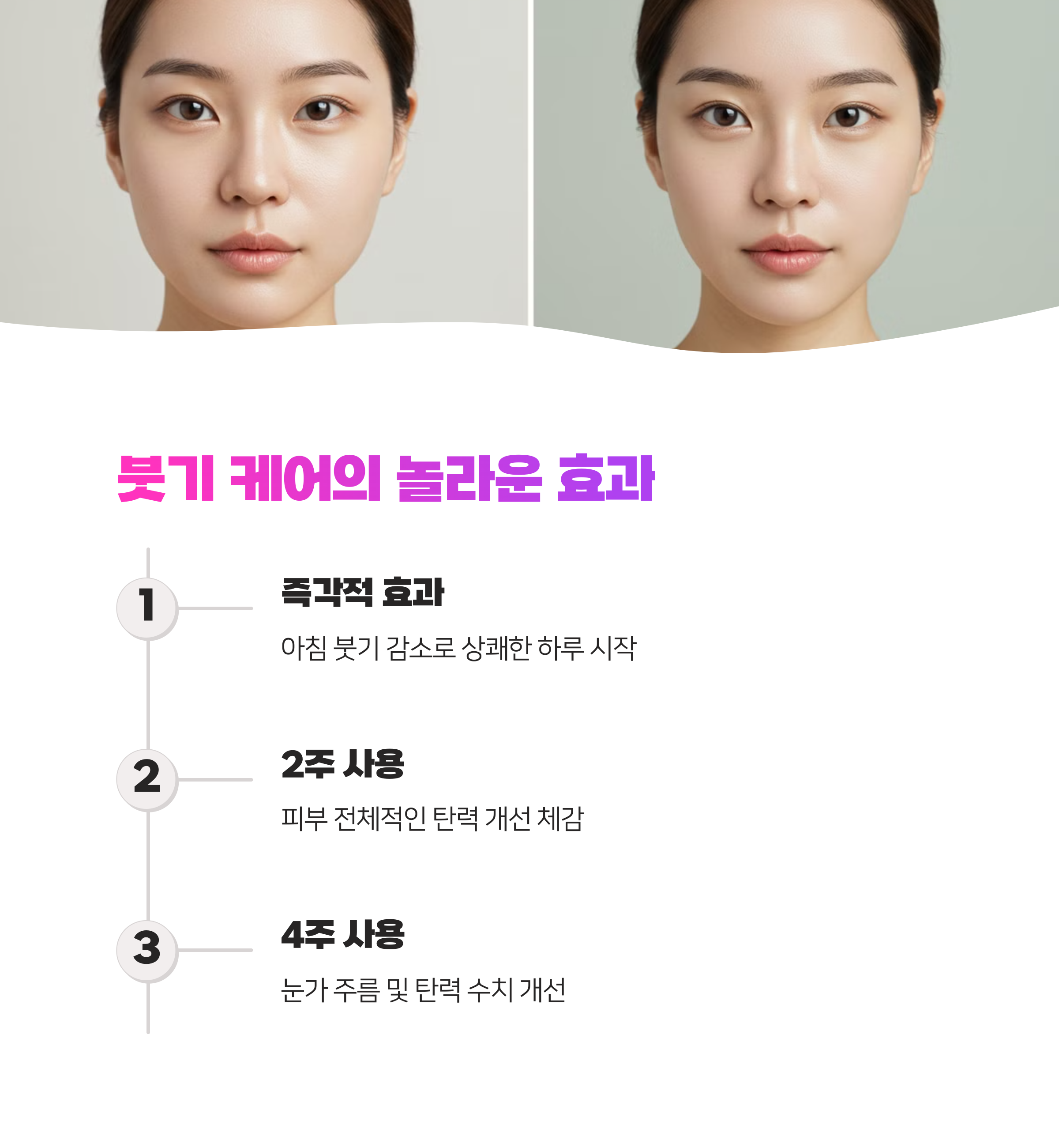 붓기 케어 방치하면 노화 가속화! VKKI 앰플로 안티에이징 시작