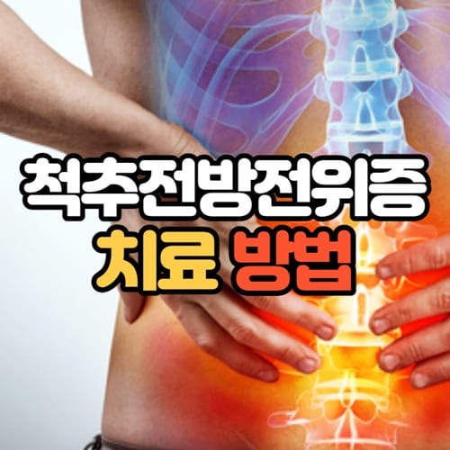 척추전방전위증 치료