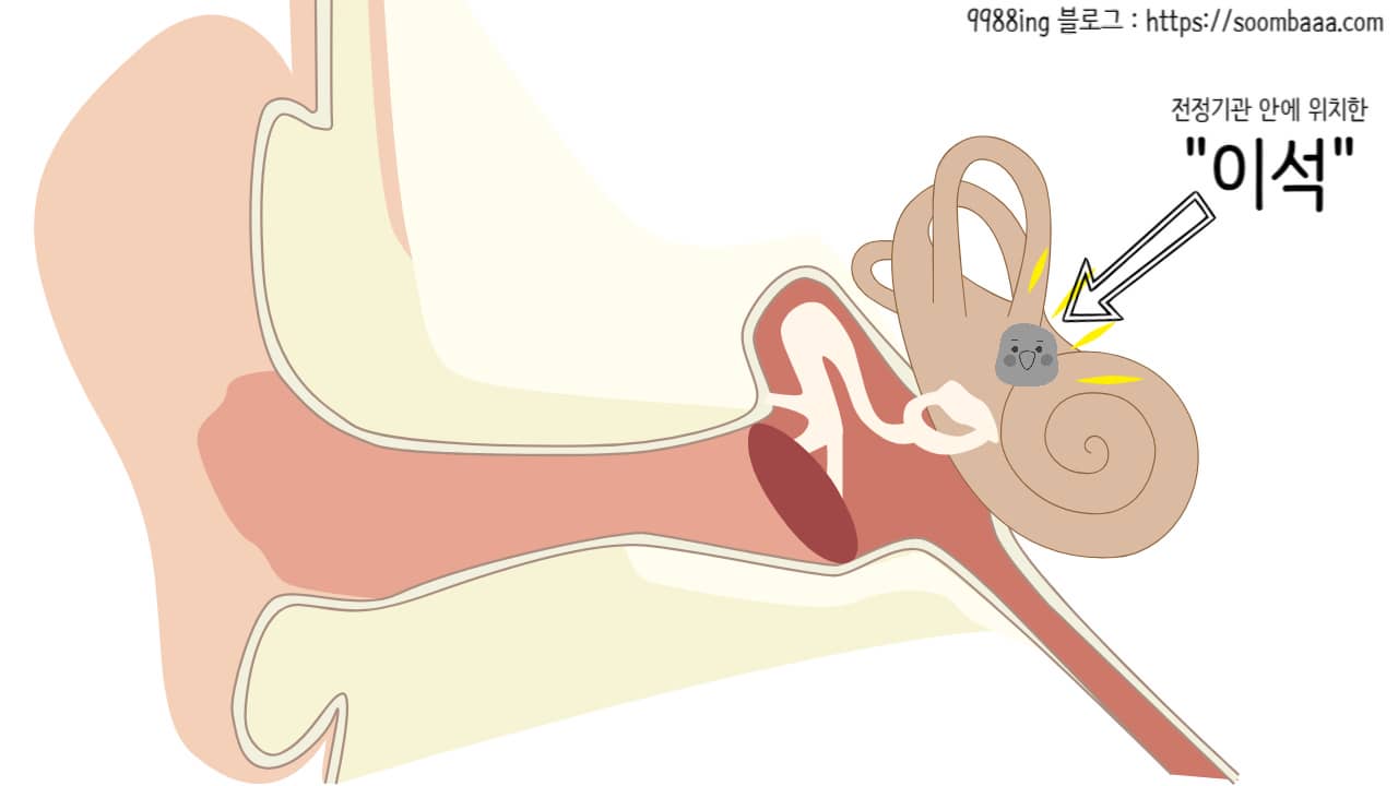 이석증의 원인을 알아야 재발 방지 및 예방이 가능하다