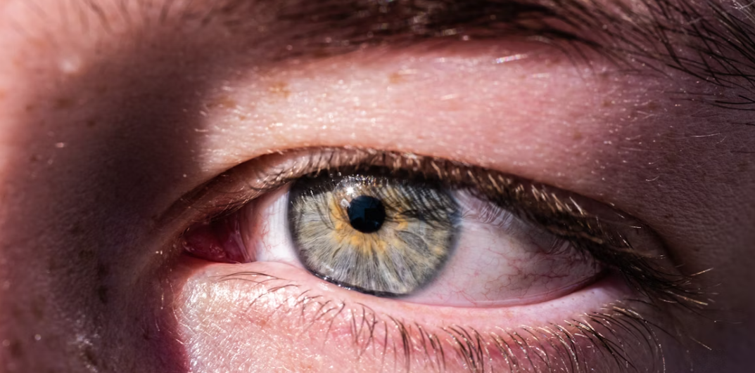 가을철 알레르기 결막염의 원인