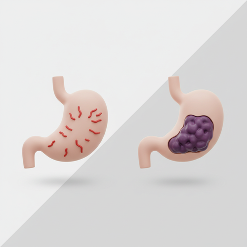 헷갈리기 쉬운 위염과 위암&amp;#44; 그 차이를 정확히 알려드릴게요.