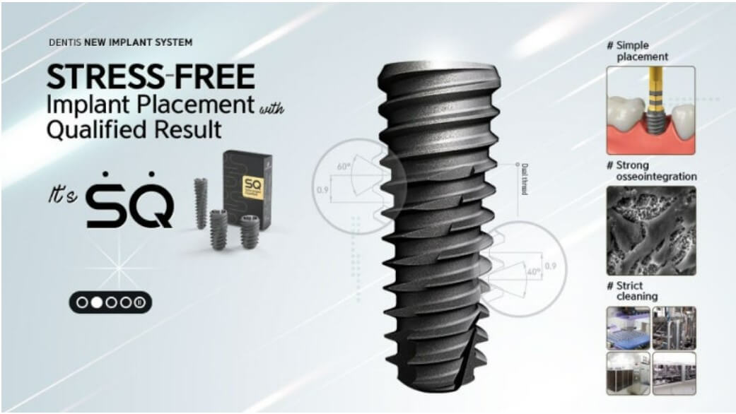 덴티움 임플란트 sq