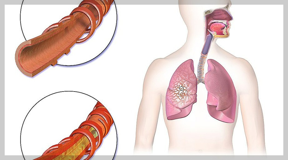 호흡기 질환: 객혈- 종류, 원인, 증상, 진단방법, 치료방법.