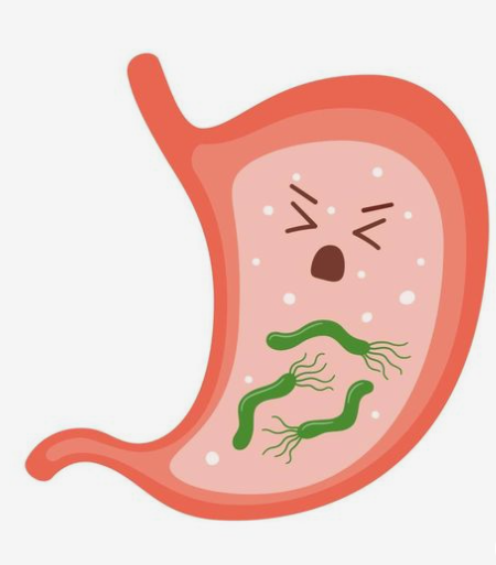 위산 역류 증상