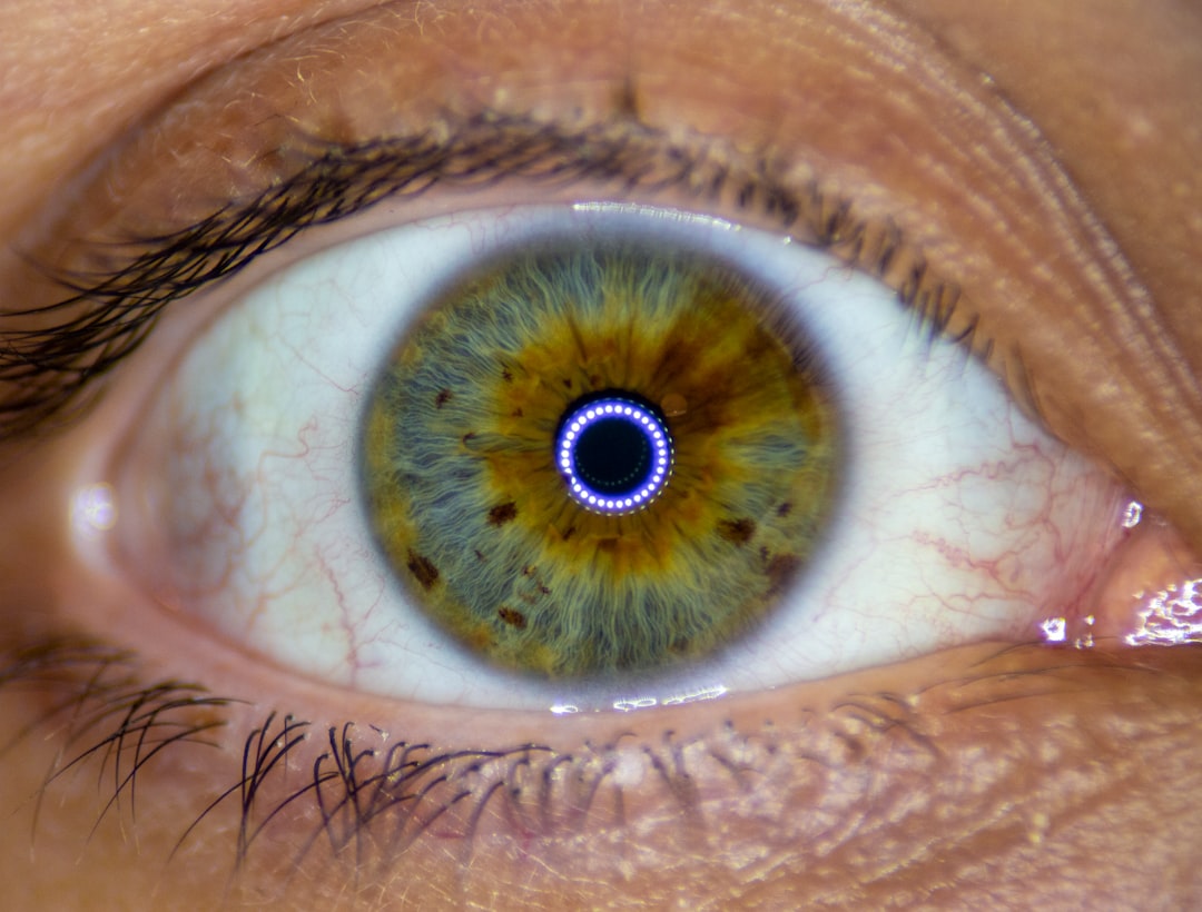 Cataract
