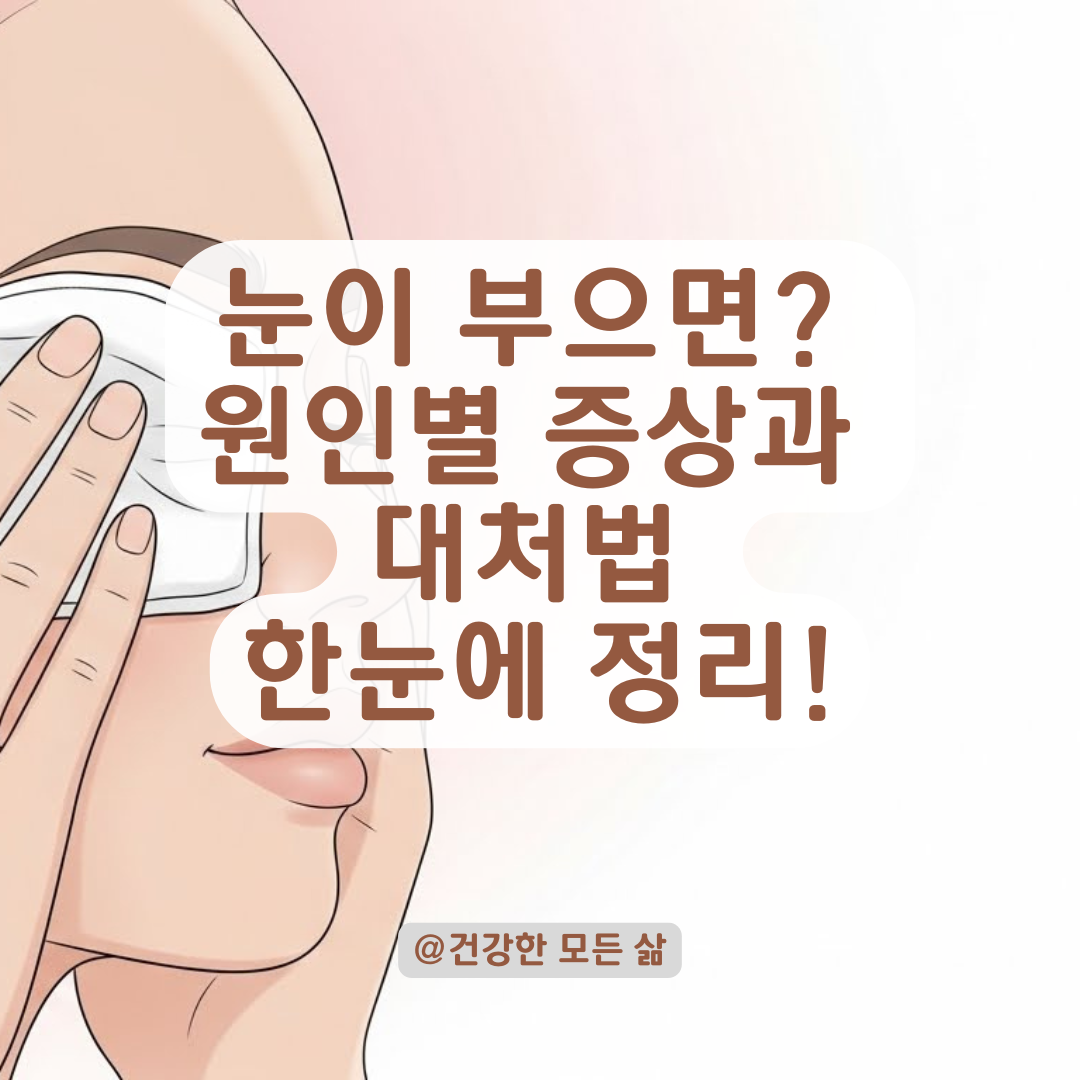 눈 비비면 바로 붓는 증상, 알레르기부터 다래끼까지 증상별 대처법 총정리.