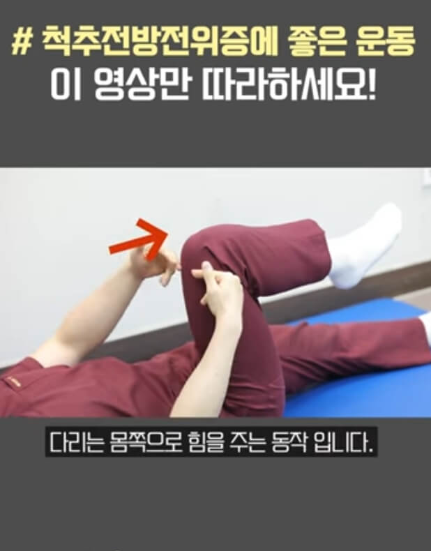 척추 전방전위증 좋은운동