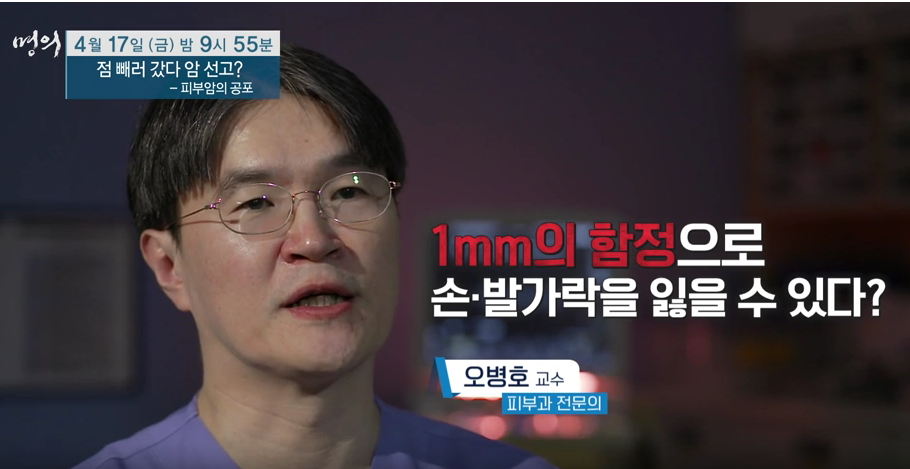 명의 피부암 점 구별법