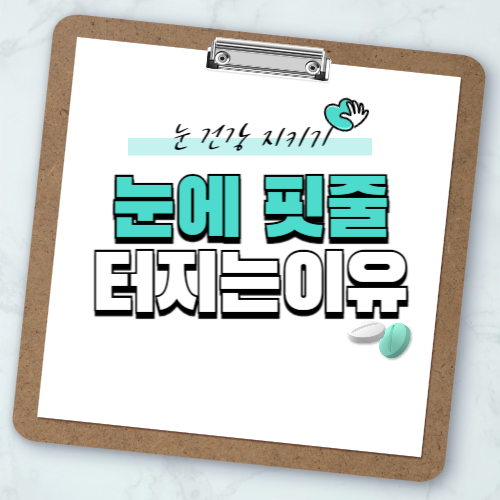 눈에 실핏줄이 터지는 이유