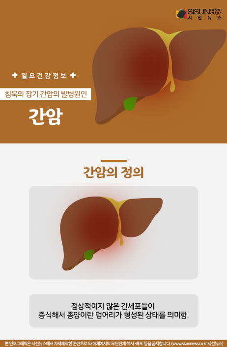 간암
