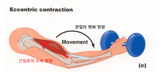 신장성 수축