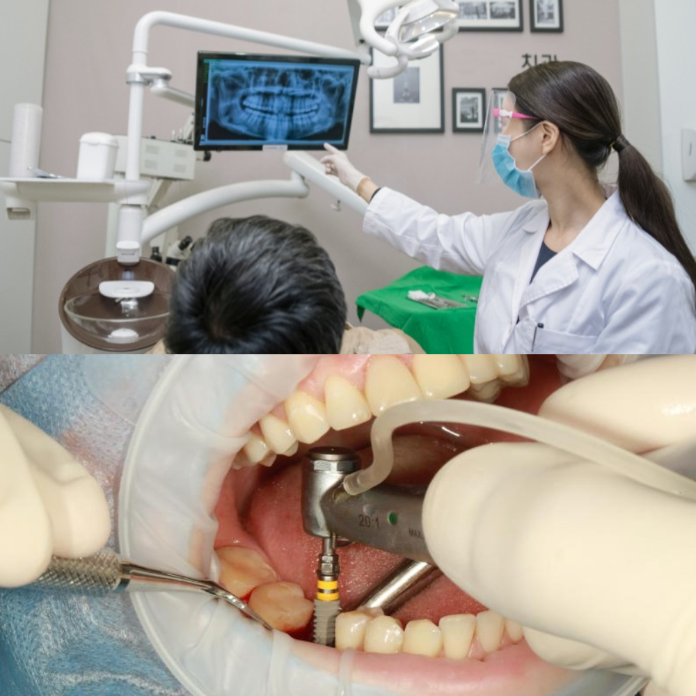 임플란트 치료 장면
